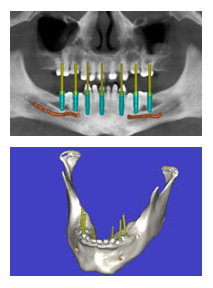 ID_ImmediateRestoration