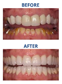 RD_Reconstruction