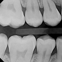 digXray