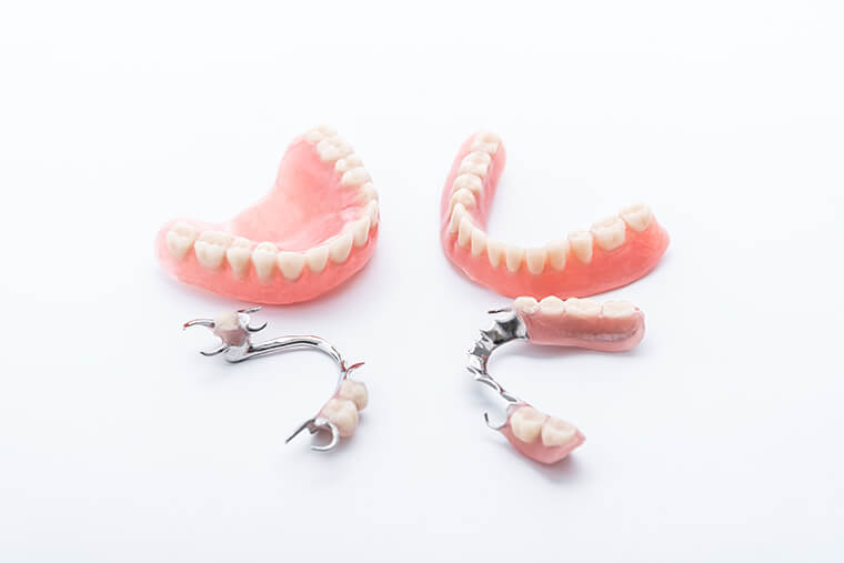 Collection of four dentures and fixed partial dentures