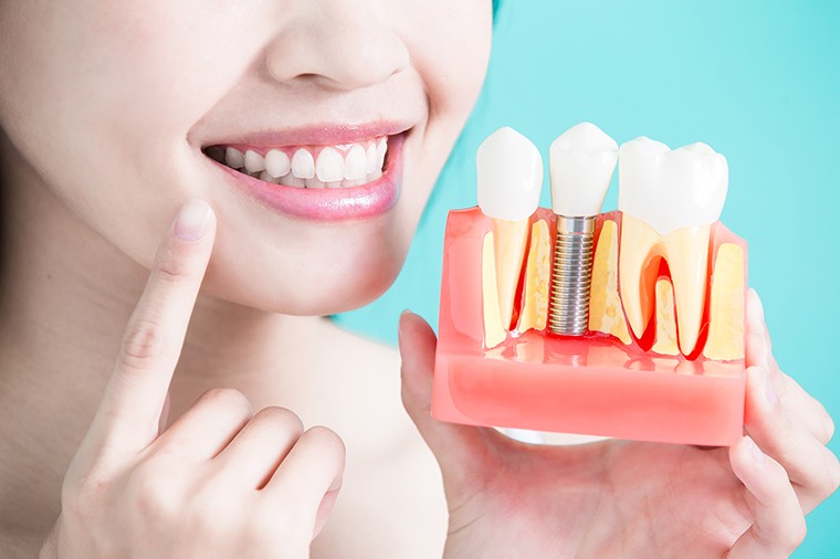 healthy dental concept