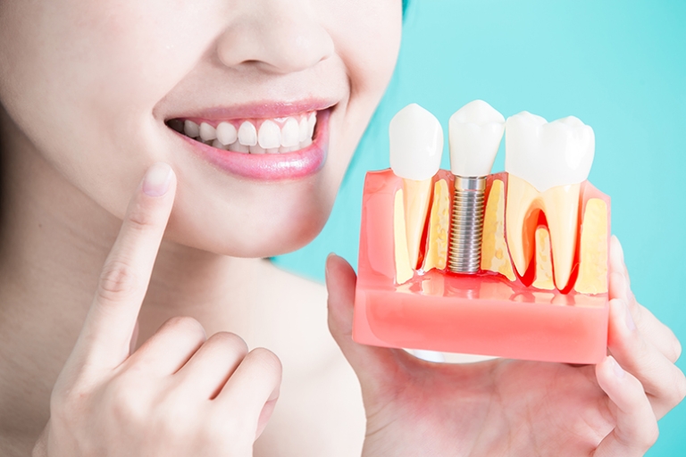woman take tooth implant false tooth on green background healthy dental concept